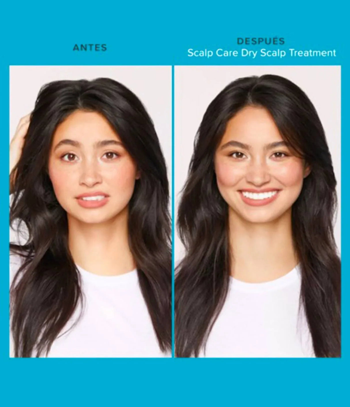 LIVING PROOF | Scalp Care Dry Treatment - 100ml - InternationalCosmetic