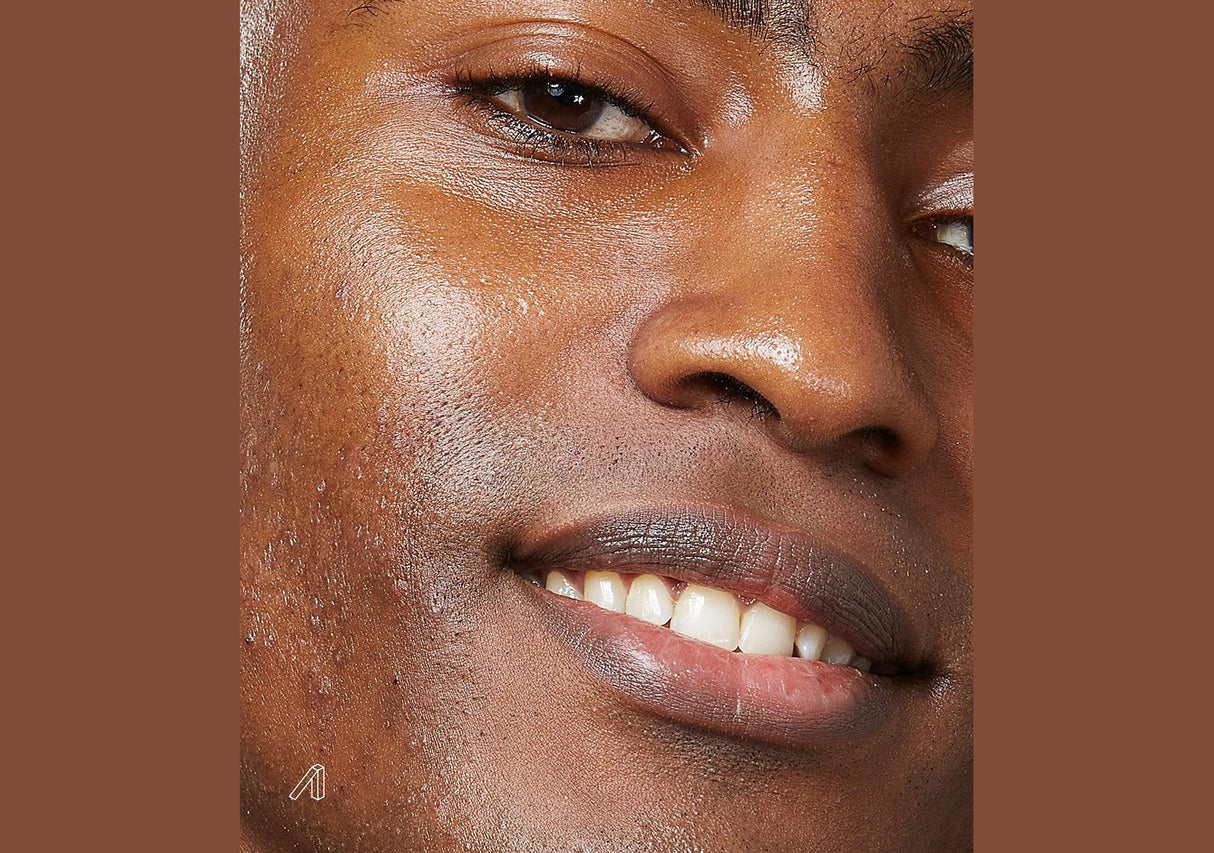 PSA | Silver Lining Dioic & Willowherb Blemish Treatment - InternationalCosmetic