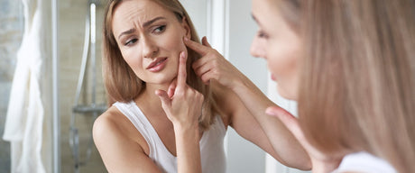 Los mejores tratamientos para el acné
