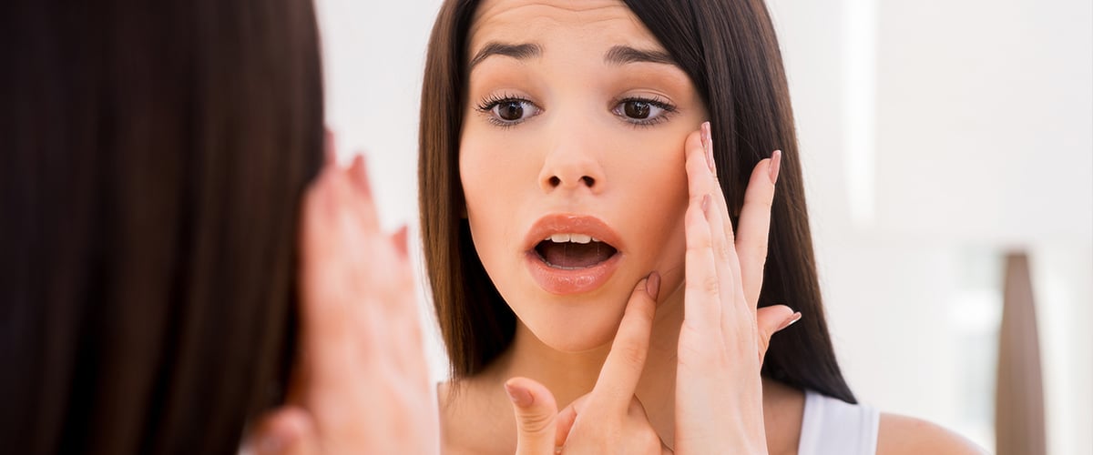 ¿Marcas Post-Acné? Te explicamos los términos Skin P.I.E y P.H.I y cómo tratarlas