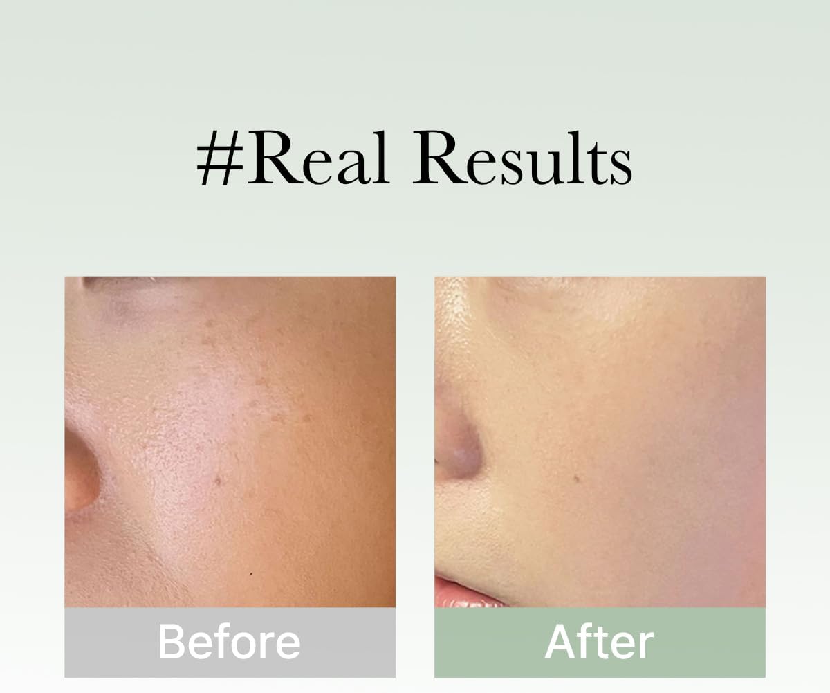 ARENCIA | Holy Hyssop Serum 30 - 50gr