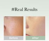 ARENCIA | Holy Hyssop Serum 30 - 50gr