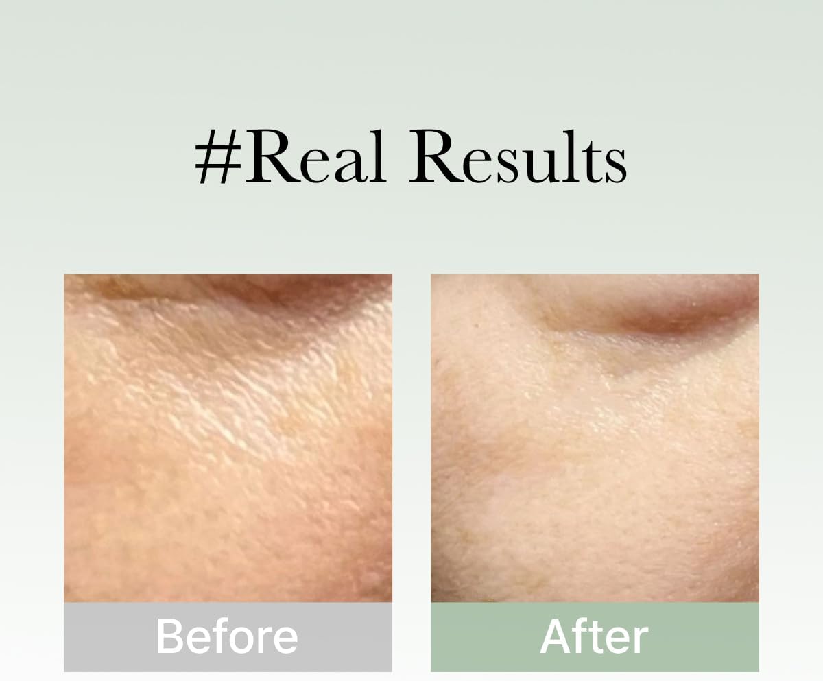 ARENCIA | Holy Hyssop Serum 30 - 50gr