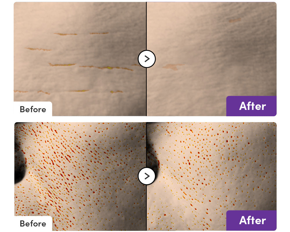 EQQUALBERRY | Bakuchiol Plumping Serum 30ml