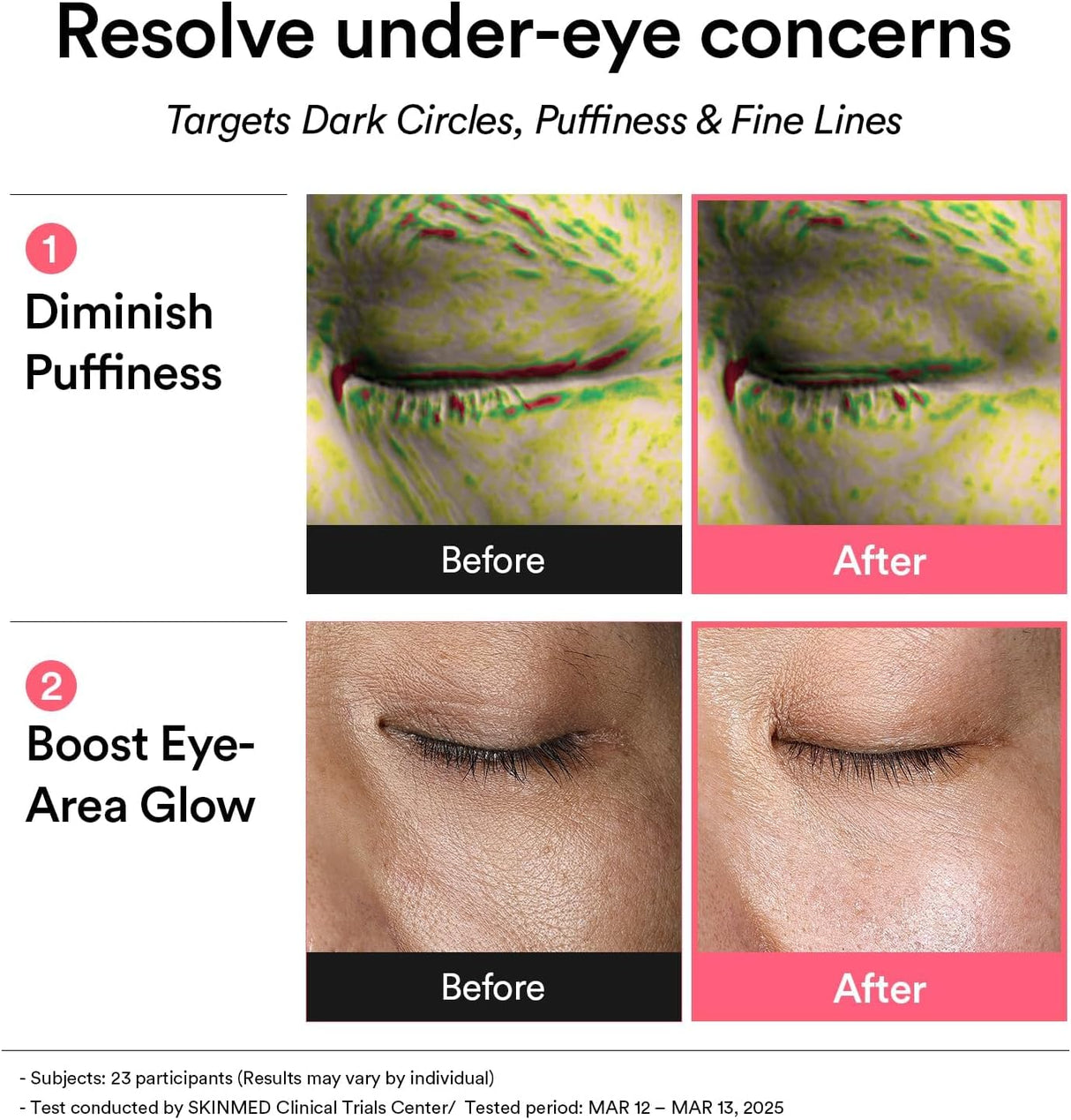ABIB | PDRN Retinal Eye Patch Glow Jelly - 60ud
