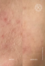 Masque pour le visage