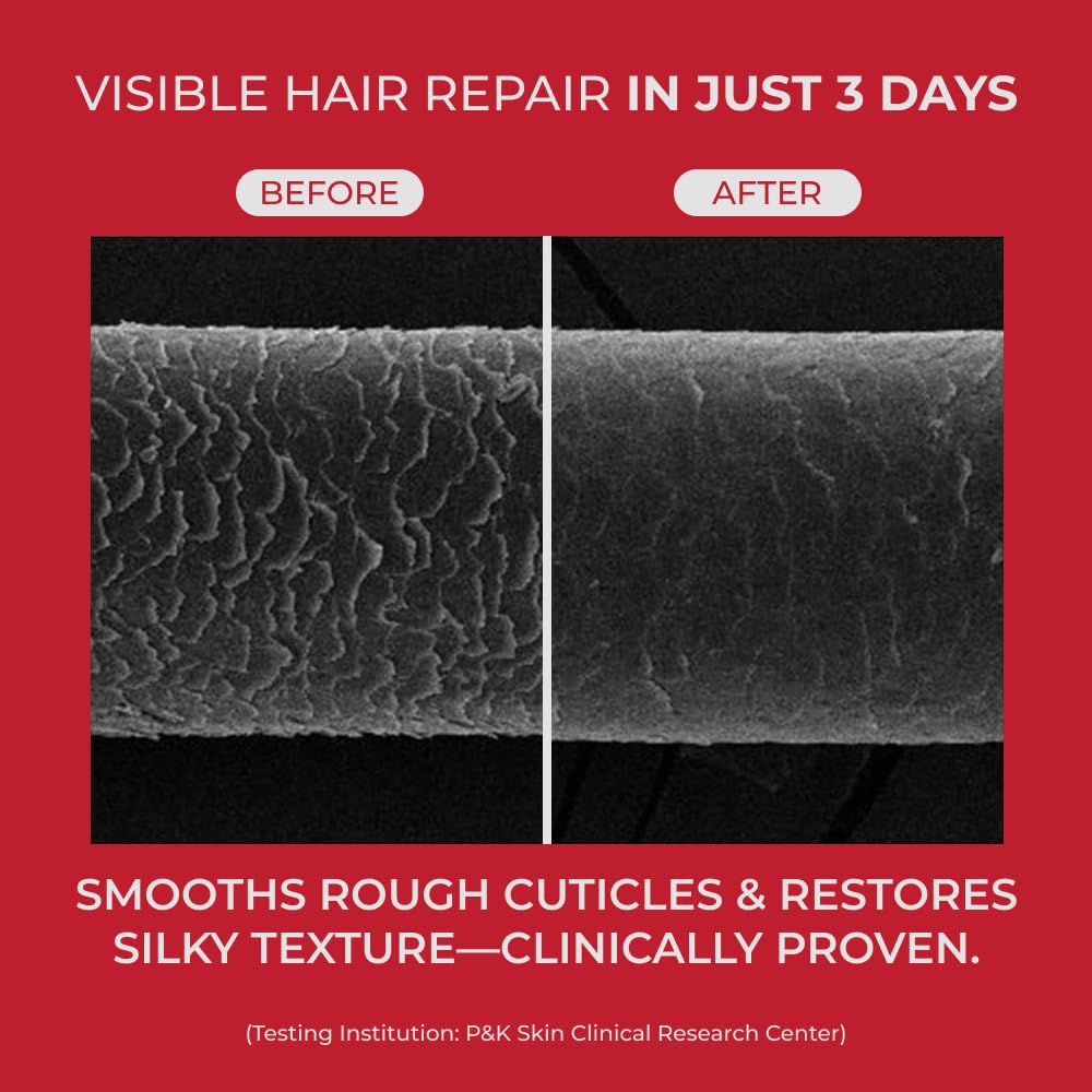 MOEV | Annurcatin Treatment - 200ml