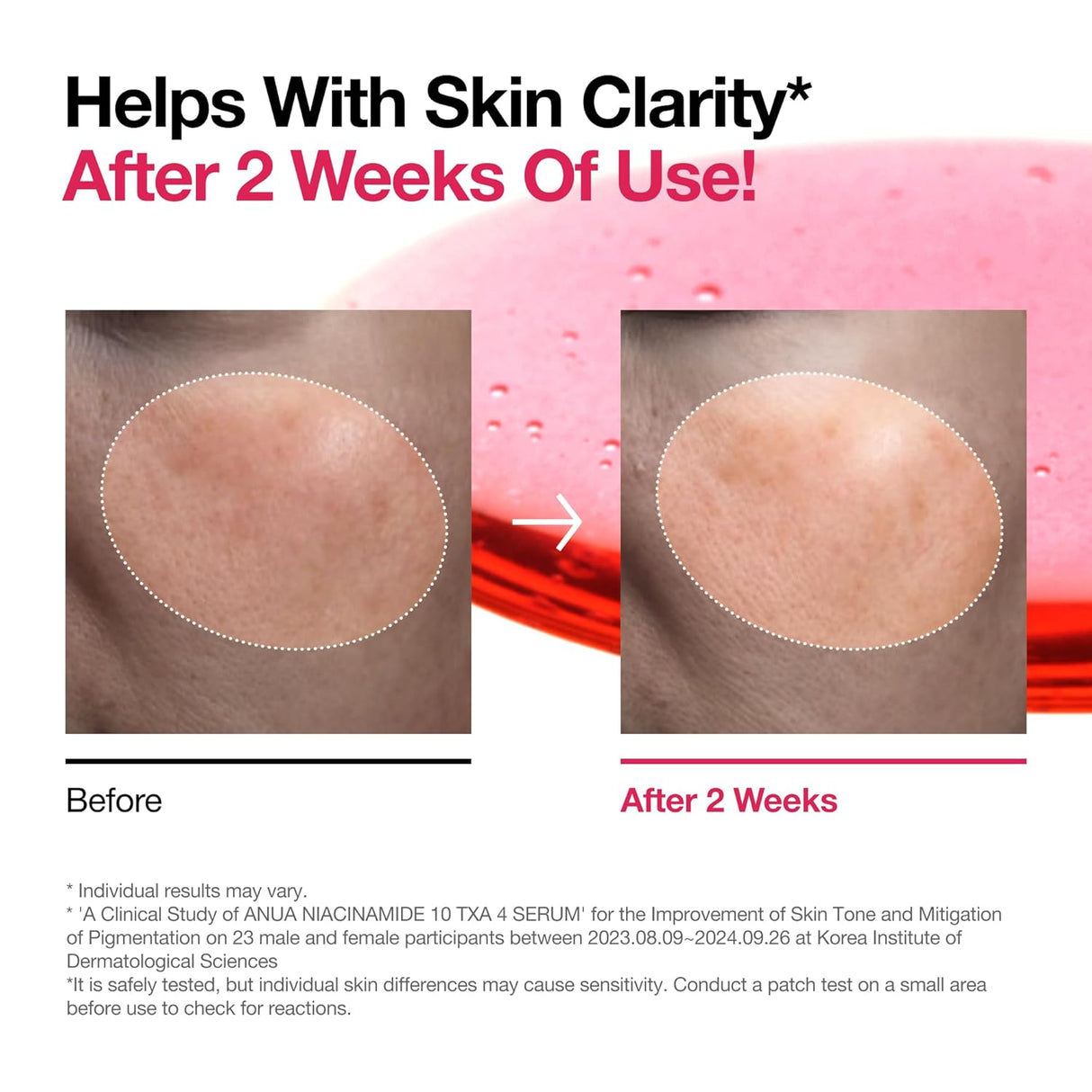 ANUA | Niacinamide 10% + TXA 4% Serum - 30ml