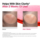 ANUA | Niacinamide 10% + TXA 4% Serum - 30ml