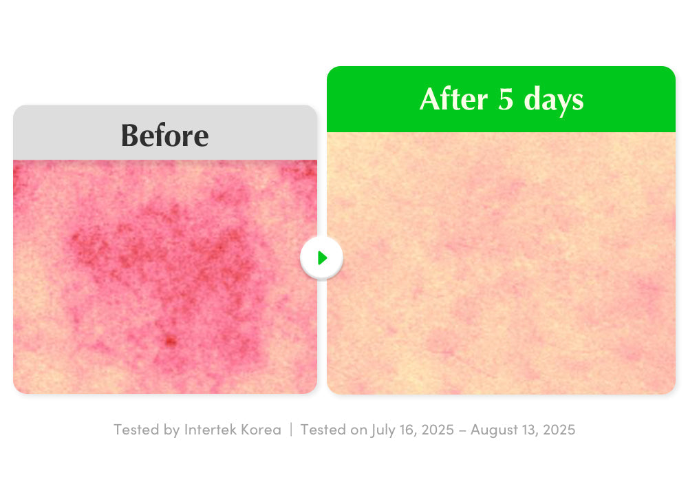 EQQUALBERRY | Aloe PDRN Calming Serum 30ml