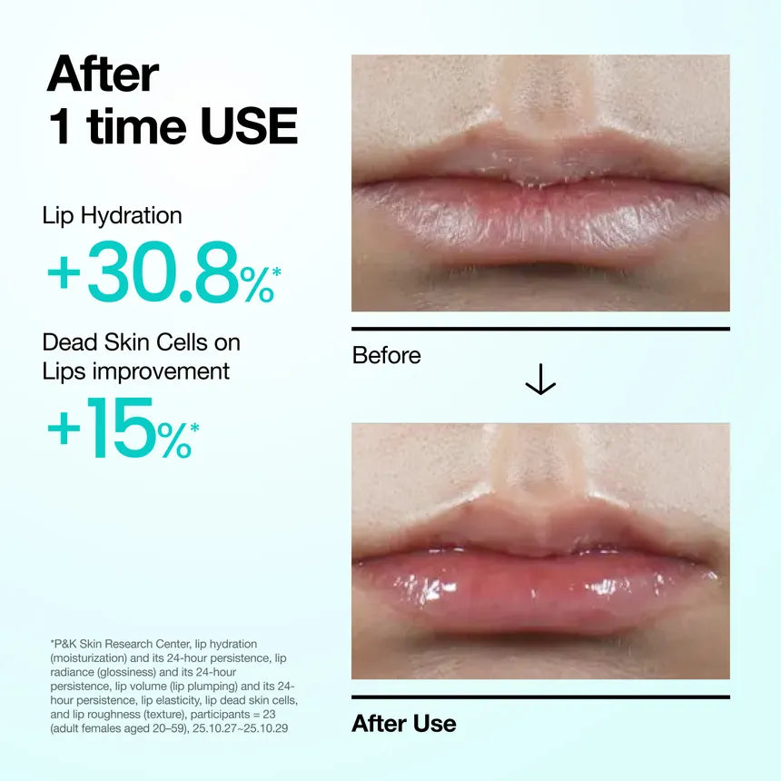 ANUA | PDRN Lip Serum - 10ml