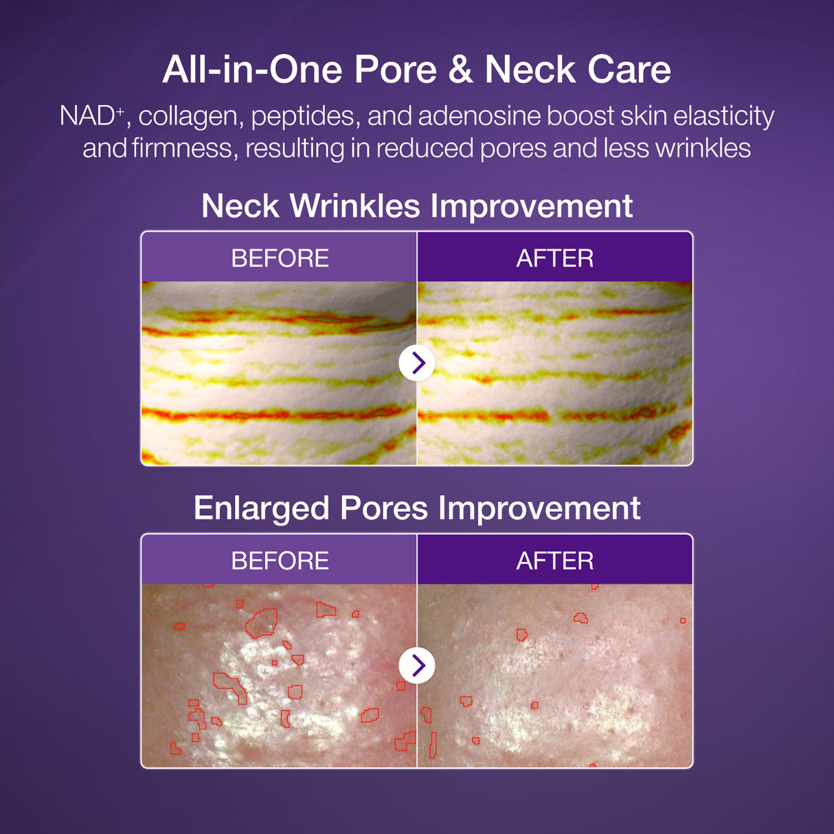 NUMBUZIN | No.9 NAD+ BIO Lifting-sil Full Face Mask (4 sheets + Lifting Band)