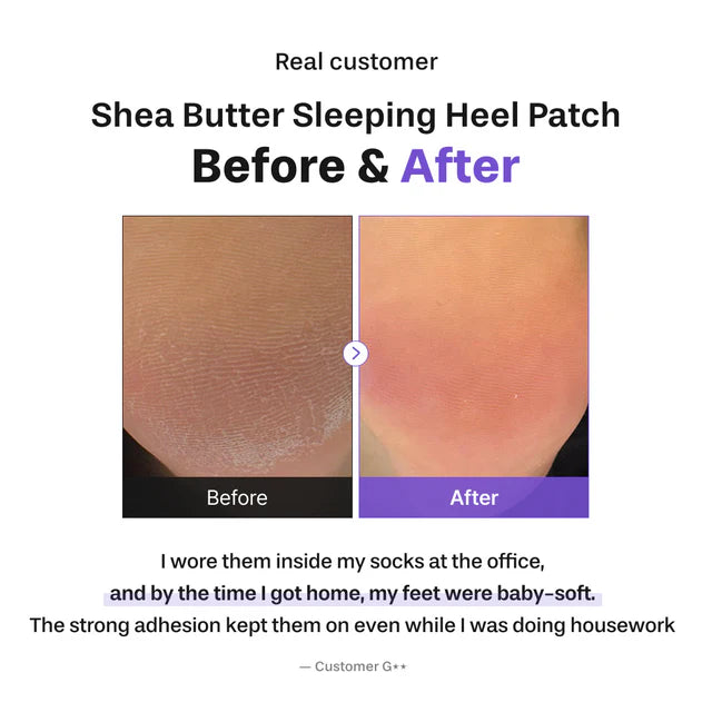 BAREN | Shea Butter Sleeping Heel Patch - 10ud