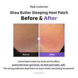 BAREN | Shea Butter Sleeping Heel Patch - 10ud