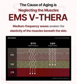 MOMMY CARE | EMS V-Thera