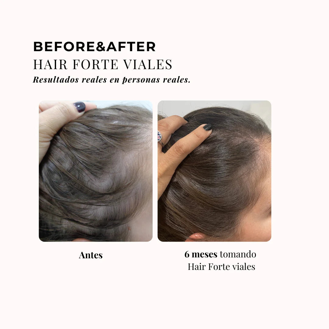 CHIC & LOVE | 360º Hair Formula Forte Elixir Cabello - 20 viales
