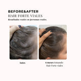 CHIC & LOVE | 360º Hair Formula Forte Elixir Cabello - 20 viales