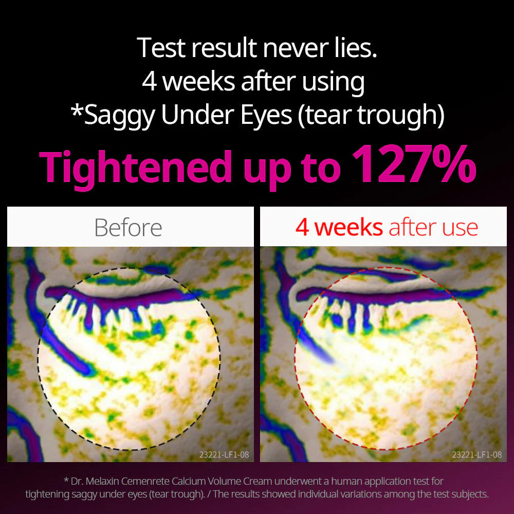 DR. MELAXIN | Cemenrete Calcium Intense Ampoule Plus - 30ml