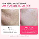 DR. MELAXIN | Cemenrete Cyano Pink Spicule Serum - 30ml