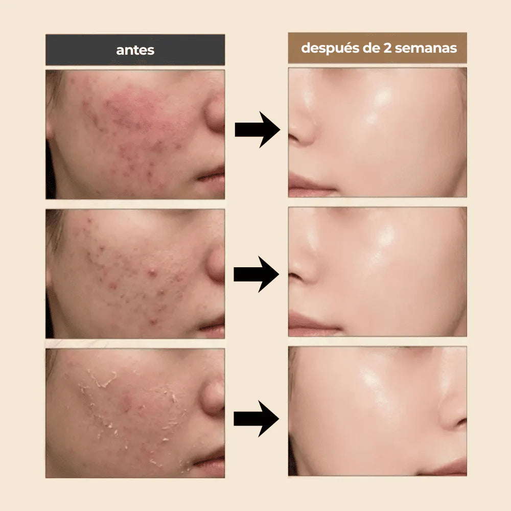 DR.REJU-ALL| Advanced PDRN Rejuvenating Cream