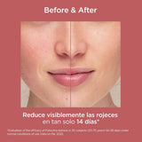 ISDIN | FotoUltra Redness SPF50 - 50ml