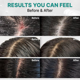 LILYEVE | Scalp: Turn Cica PDRN Deep Clean Shampoo - 500gr