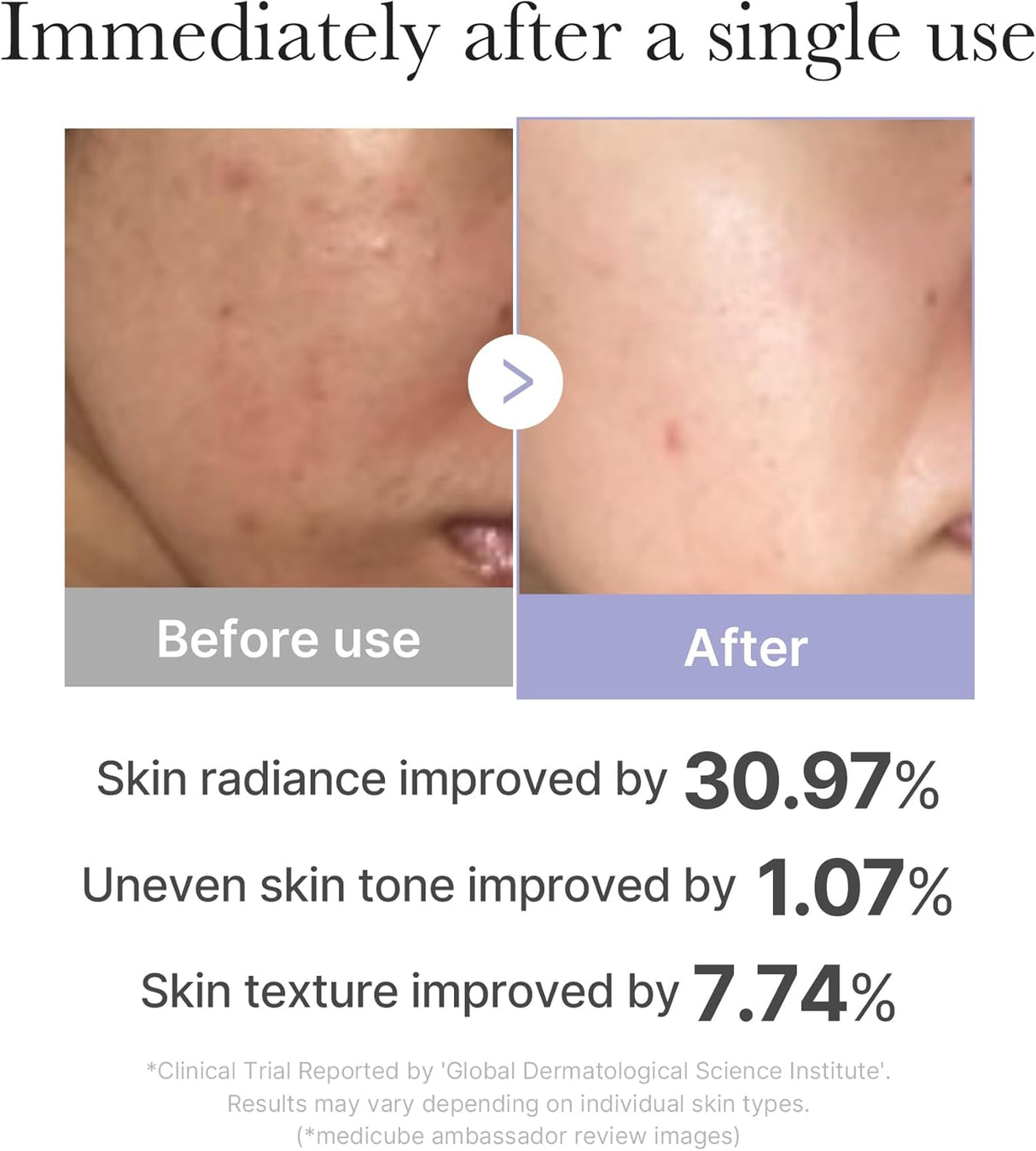 MEDICUBE | AGE-R Booster Pro Mini - Pink