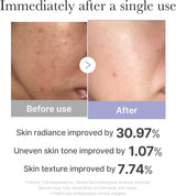 MEDICUBE | AGE-R Booster Pro Mini - Pink