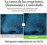 EXOSOME CICA TONER