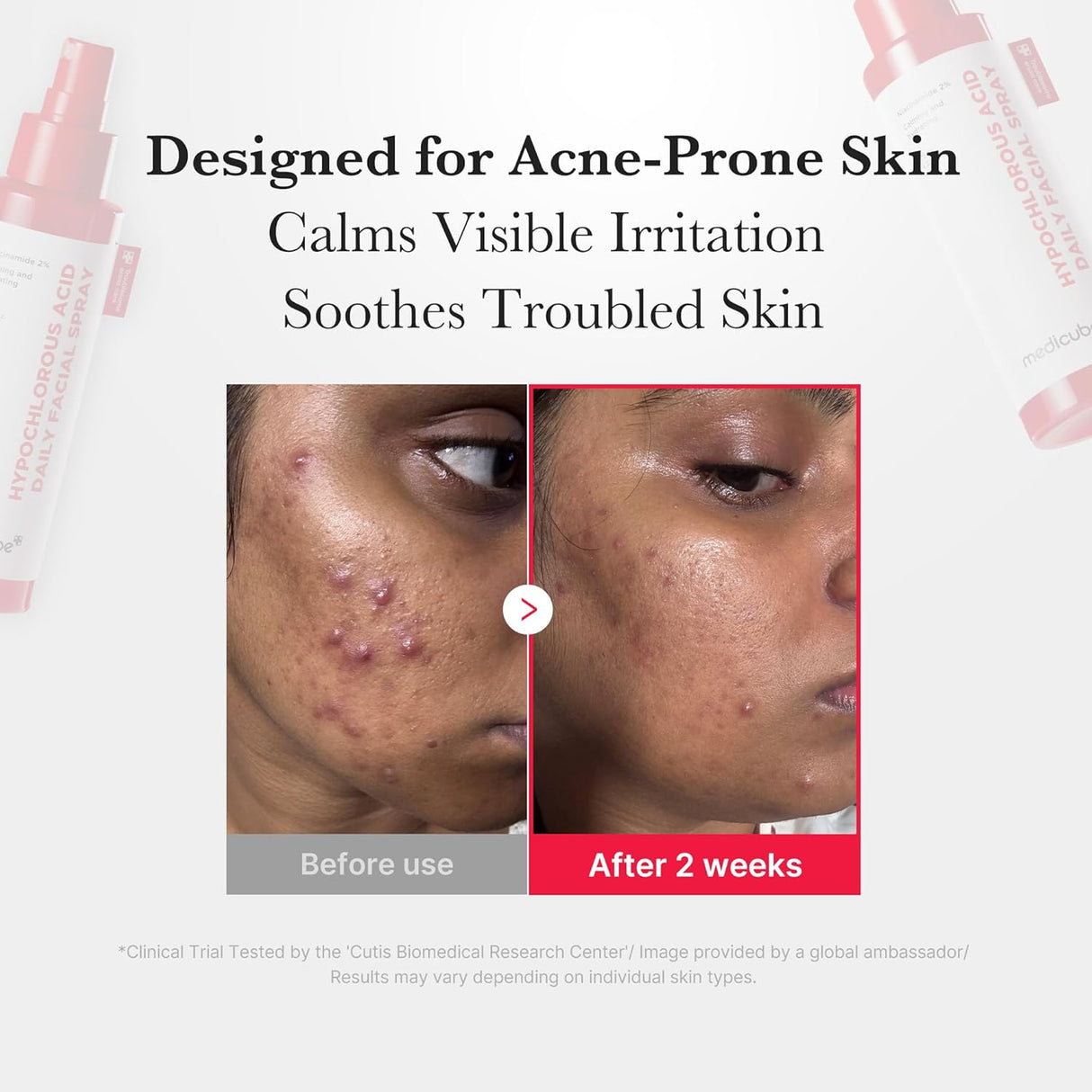 MEDICUBE | Hypochlorous Acid Daily Facial Spray