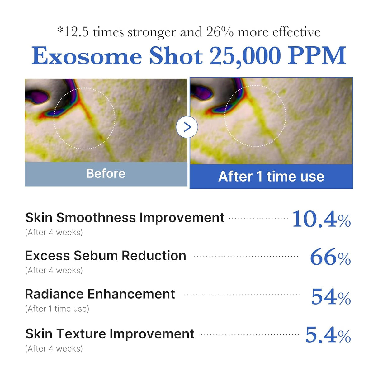 MEDICUBE | One Day Exosome Shot Pore Ampoule 25000 - 13ml