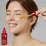 RED ACNE SUCCINIC ACID PEEL