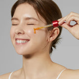 RED ACNE SUCCINIC ACID PEEL
