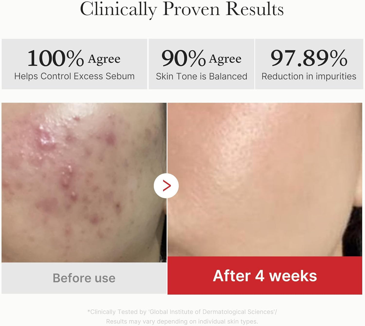 MEDICUBE | Red Succinic Acid Peeling Pad - 70 ud