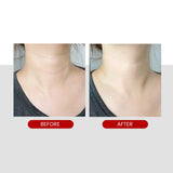 MEDIPEEL | Peptide Naite 1000 Shot Neck Stick - 20gr