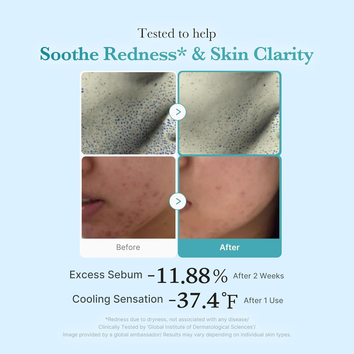 MEDICUBE | Azelaic Acid Niacinamide Clear Toner - 250ml