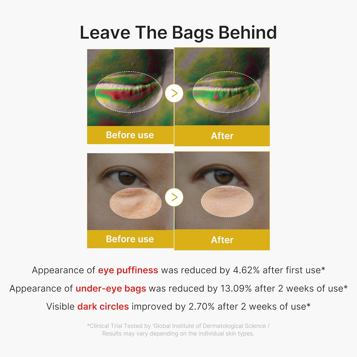 MEDICUBE | Kojic Acid Turmeric Vita Eye Gel Serum - 30ml