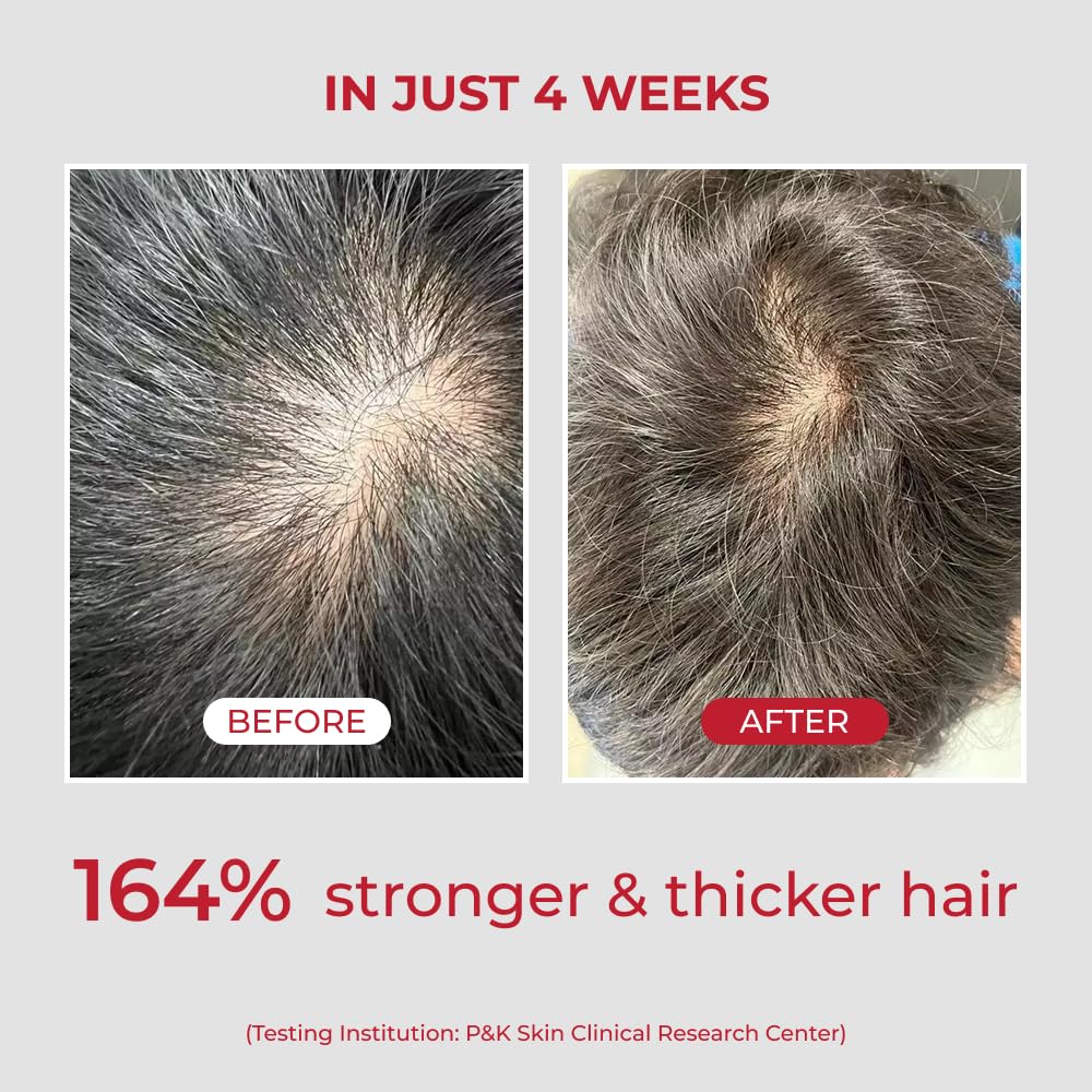 MOEV | Annurcatin Shampoo