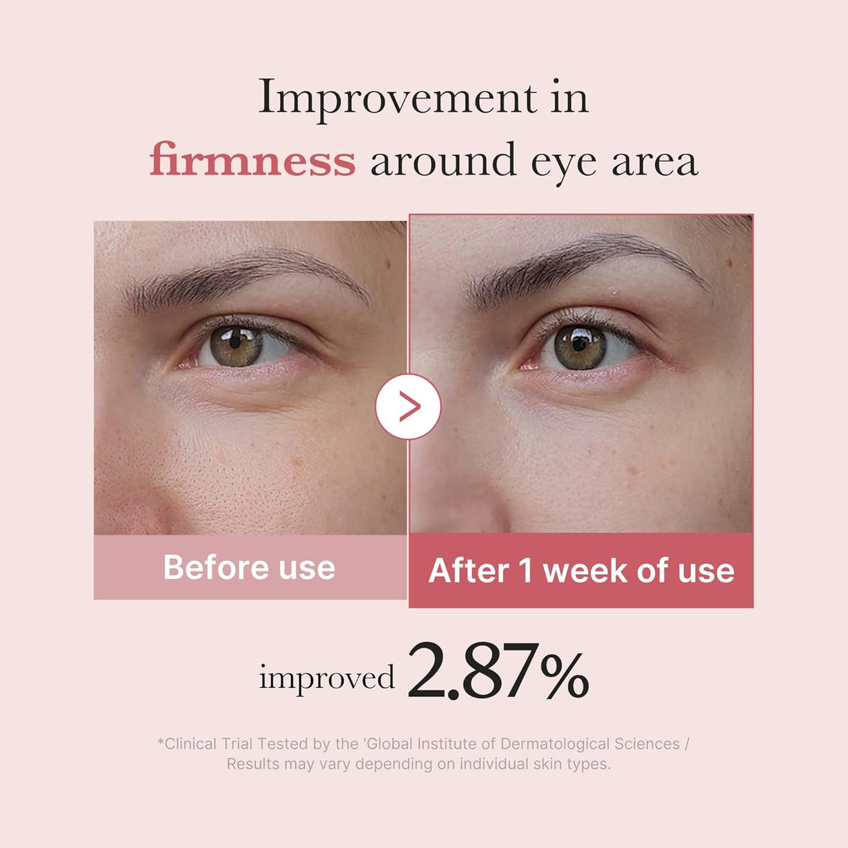 MEDICUBE | PDRN Pink Peptide Eye Cream - 30 ml