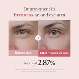 MEDICUBE | PDRN Pink Peptide Eye Cream - 30 ml