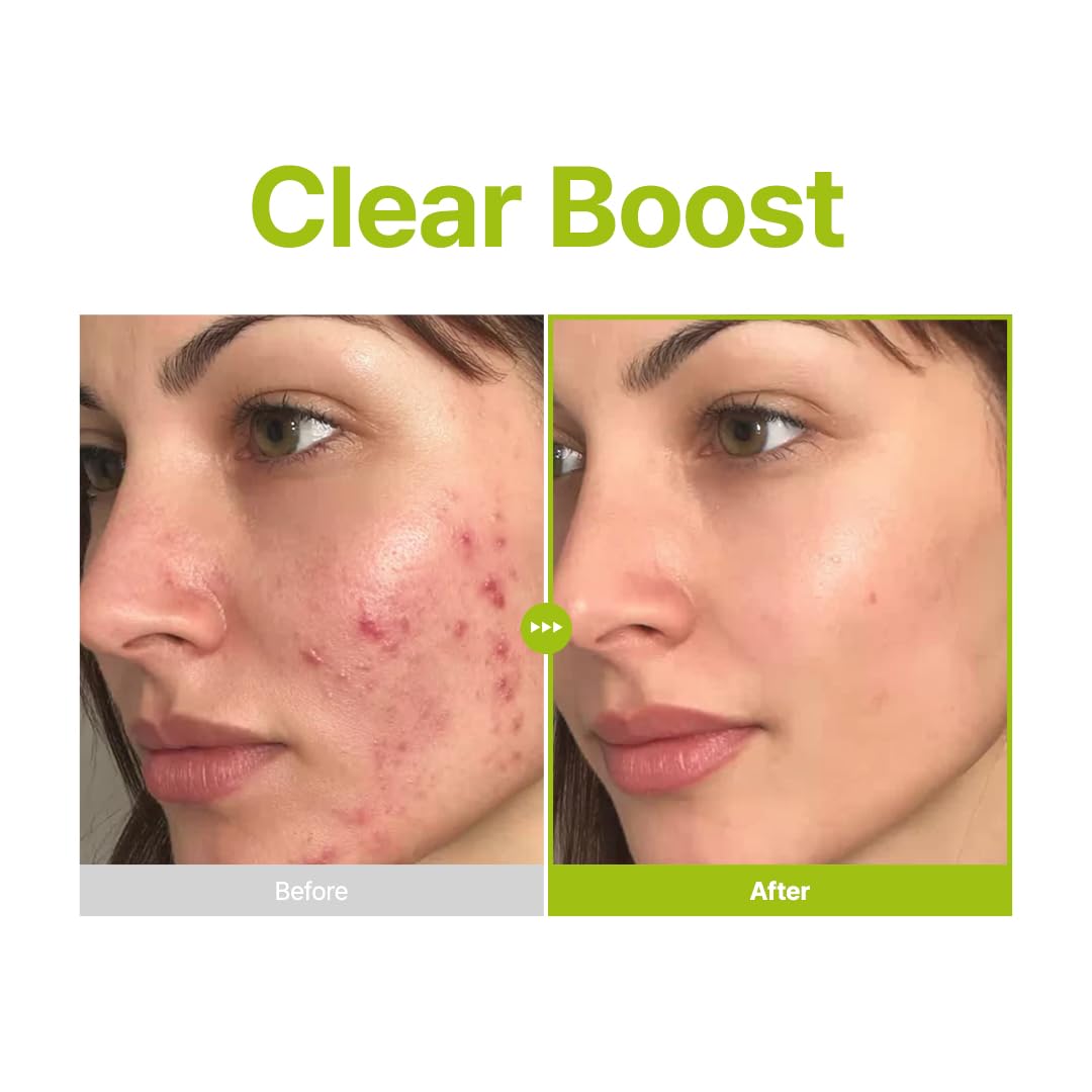 PURITO | Azelaic Acid 10 Kojic Tea Tree Serum - 30ml