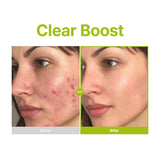 PURITO | Azelaic Acid 10 Kojic Tea Tree Serum - 30ml