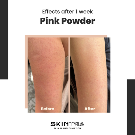 Skintra - Pink Pow(d)er