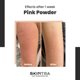 Skintra - Pink Pow(d)er