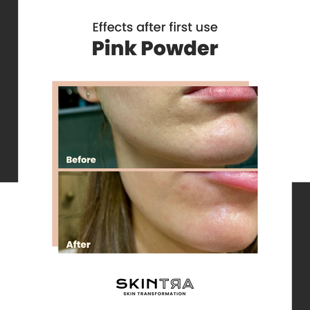 Skintra - Pink Pow(d)er