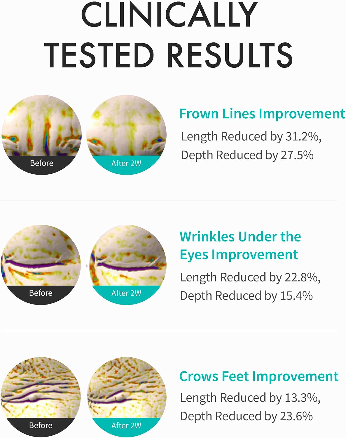 REJURAN | Intensive Eye Cream - 20ml
