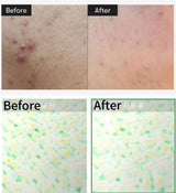 VT COSMETICS | Cosmetics Reti‑A Reedle Shot 700 - 30ml