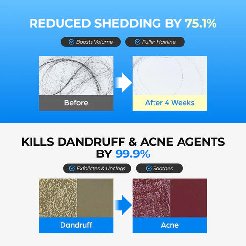 SEAPURI | Scalpy Bubble Tonic - 100ml