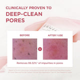 SKIN 1004 | Madagascar Centella Poremizing Deep Cleansing Foam - 125ml