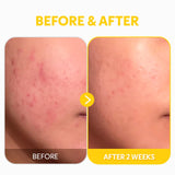 TIRTIR | Pure Vitamin C24% Serum - 30 ml